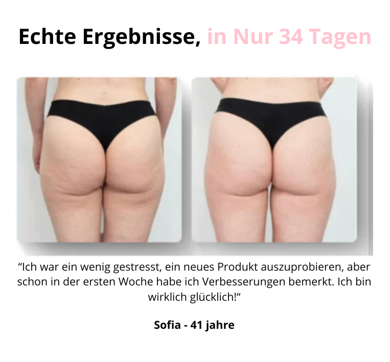 Velara™ - Massagegerät