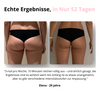 Velara™ - Massagegerät