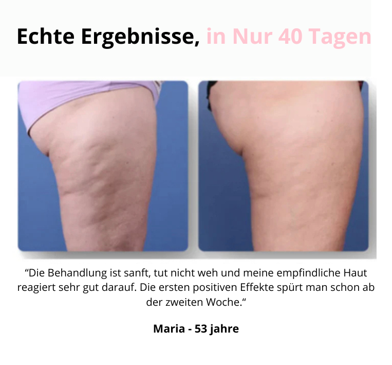 Velara™ - Massagegerät